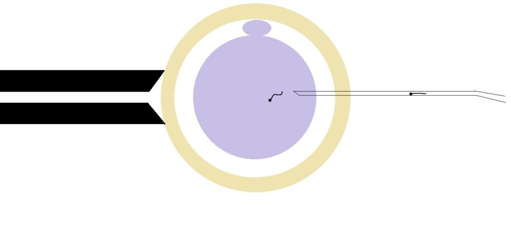 icsi ivf | male infertility | male fertility | ivf process